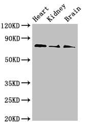 SLC5A1 / SGLT1 Antibody