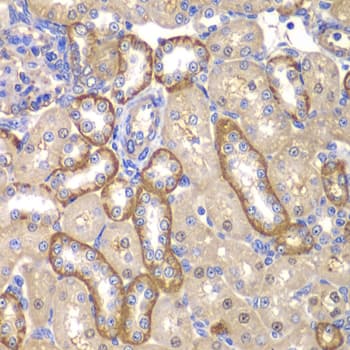 Polyclonal Rabbit anti-Human MMP14 Antibody (IHC, WB)