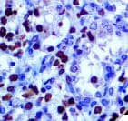 HSV-1 / Herpes Simplex Virus 1 Antibody (clone 10A3)