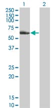 IHC-plus™ NR2C2 / TAK1 Antibody (clone 2A5)
