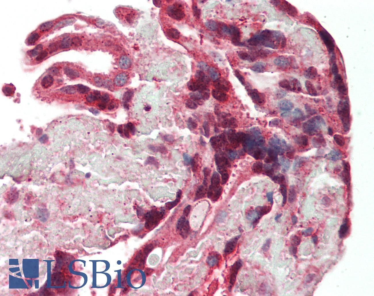 IHC-plus™ DAPK1 / DAP Kinase Antibody (aa38-374)