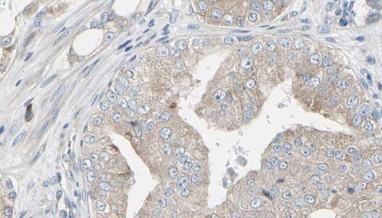 RIOK1 Antibody