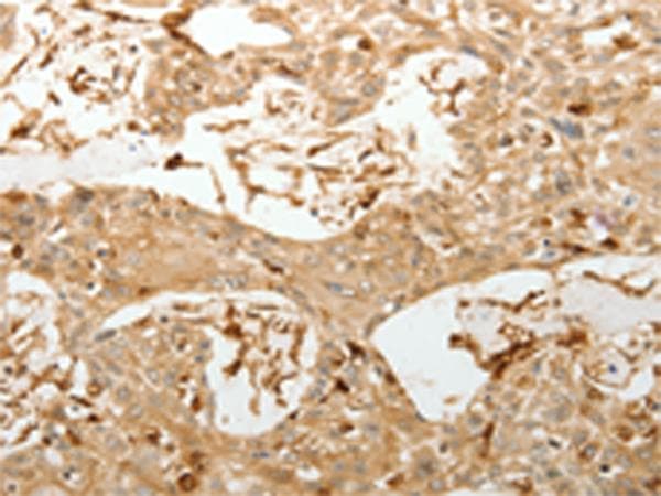 VMA21 / XMEA Antibody