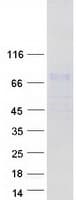 Human POMGNT2 / GTDC2 Protein (Recombinant Myc-DDK (Flag))