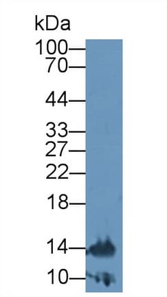 LTA / TNF Beta Antibody (aa35-191, Biotin)