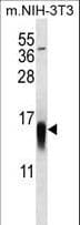 MAP1LC3B / LC3B Antibody (aa9-33)