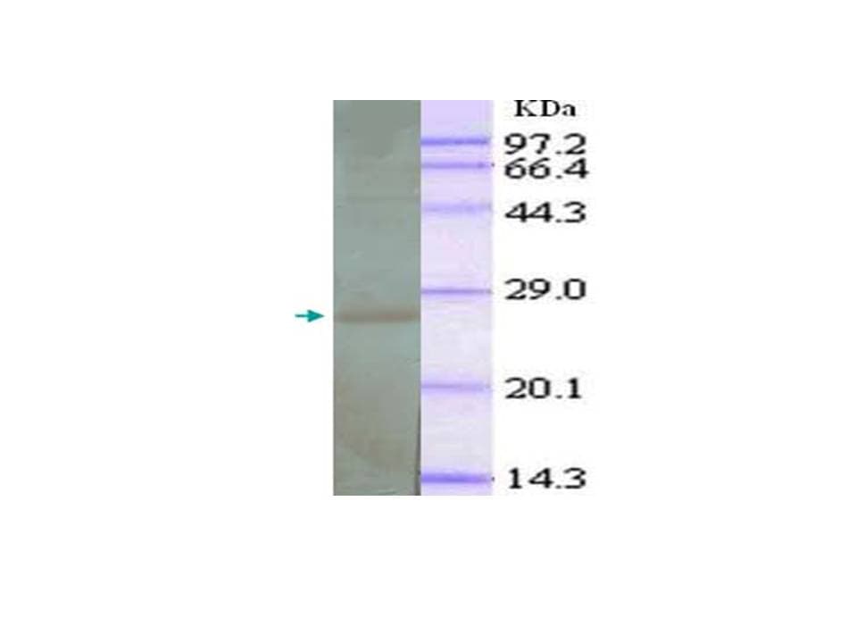 IL6 / Interleukin 6 Antibody