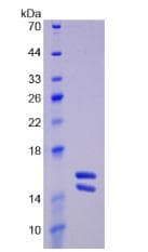 Human IL23 Protein (Recombinant His)