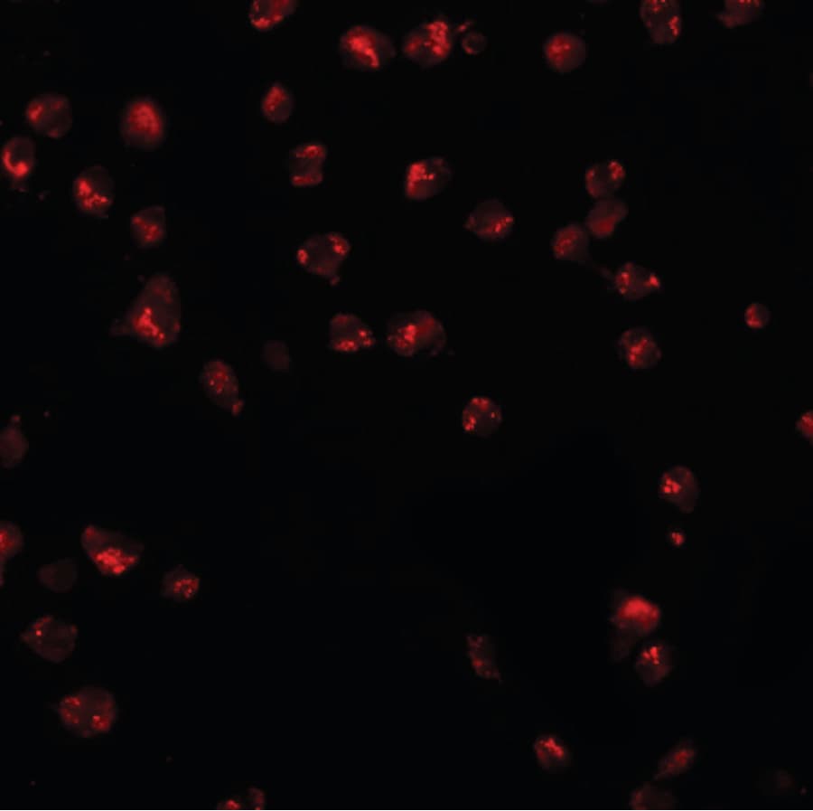 IHC-plus™ Polyclonal Rabbit anti-Human KPNA3 / Importin Alpha 4 Antibody (IHC, IF, WB)