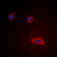 Polyclonal Rabbit anti-Human GAP43 Antibody (N-Terminus, IHC, IF, WB)