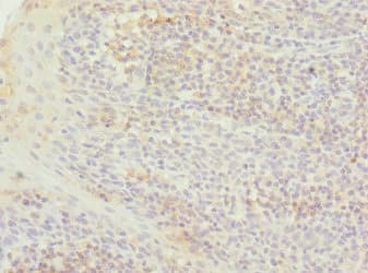 TXNL4B Antibody