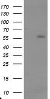 TRAIP / TRIP Antibody (aa67-313, clone OTI1G3, Carrier-free)