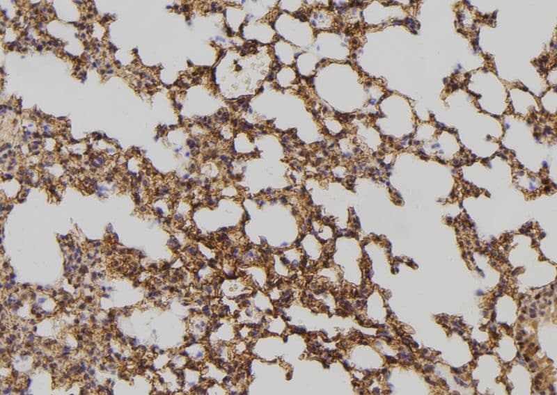 Polyclonal Rabbit anti-Human DHRS4 / PSCD Antibody (IHC, IF, WB)