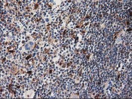 SQSTM1 Antibody (clone OTI4G9)