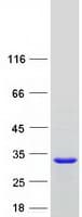 Human RABL3 Protein (Recombinant Myc-DDK (Flag))