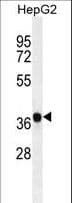 IHC-plus™ BABP / AKR1C2 Antibody (aa296-323)