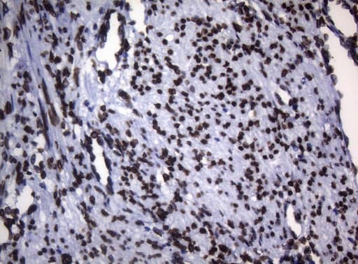 BCL6 Antibody (aa1-300, clone OTI1C3, Carrier-free)