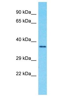 GPR89A Antibody (aa285-334)