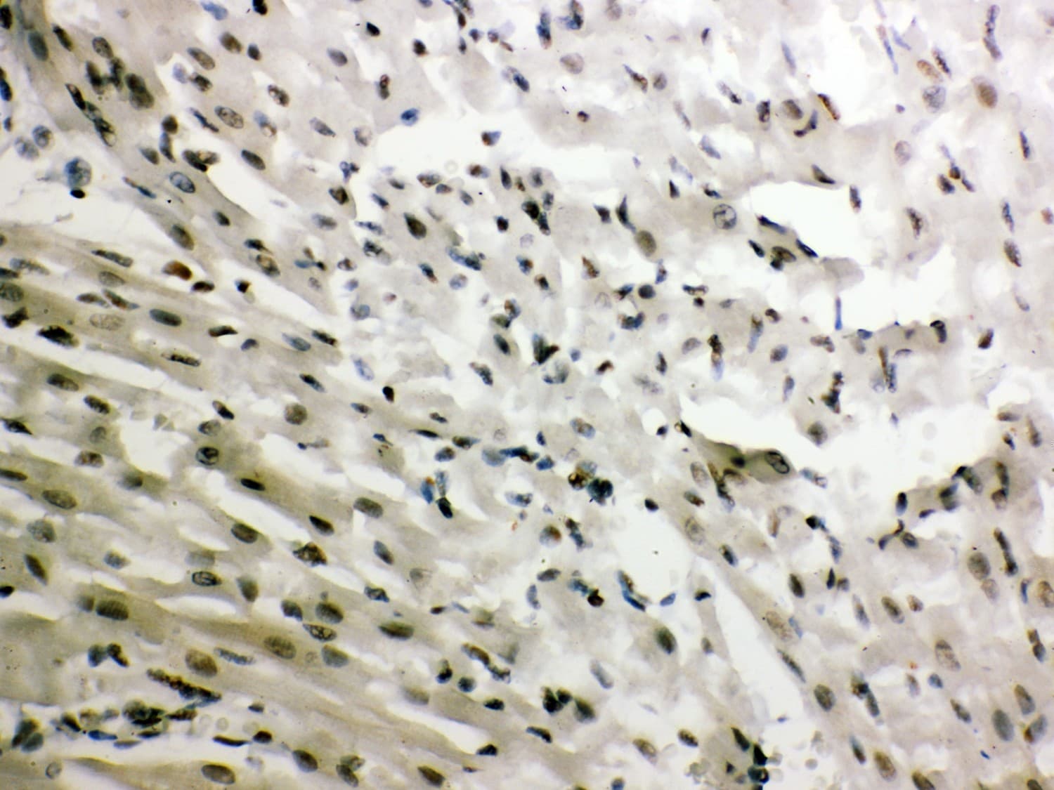 NR3C1/Glucocorticoid Receptor Antibody (aa20-199)