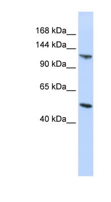 Polyclonal Rabbit anti-Human CEB1 / HERC5 Antibody (aa900-949, IHC, WB)