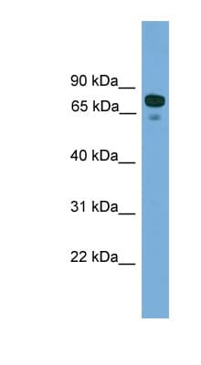 Polyclonal Rabbit anti-Human ZNF599 Antibody (N-Terminus, WB)
