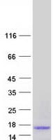 Human HAMP / Hepcidin Protein (Recombinant Myc-DDK (Flag))