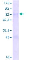 Human IMP4 Protein (Recombinant GST)