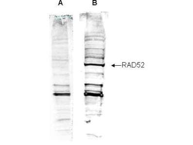 IHC-plus™ RAD52 Antibody