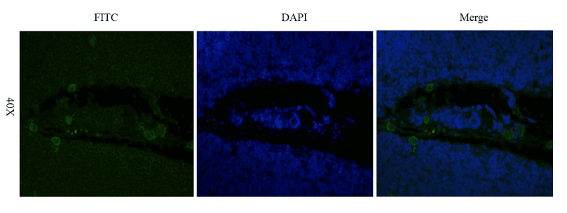 IL2RA / CD25 Antibody (IL-2R alpha (CD25), clone Basiliximab)