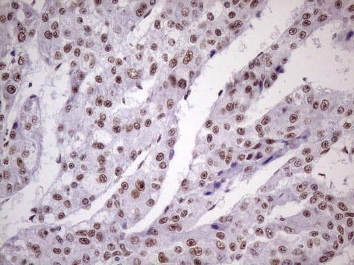 Monoclonal Mouse anti-Human NUDT21 Antibody (clone OTI1B1, Carrier-free, aa2-227, IHC, IF, WB)