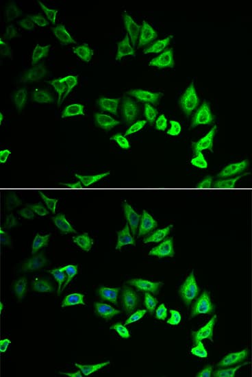 Polyclonal Rabbit anti-Human MYOZ2 / CS-1 Antibody (IHC, IF, WB)