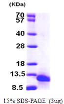 Human CCL18 / PARC Protein (Recombinant His)