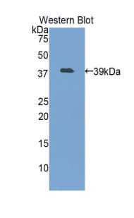 Lumican Antibody (aa19-338)