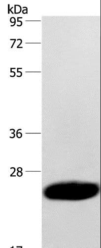 Polyclonal Rabbit anti-Human CAV3 / Caveolin 3 Antibody (IHC, WB)