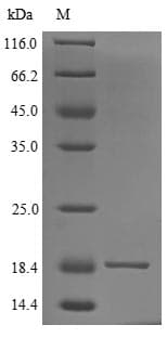Human LYNX1 Protein (Recombinant 6His, N-terminus)