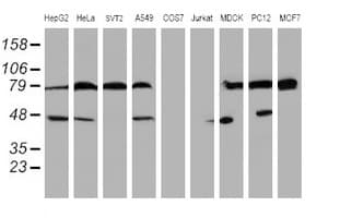 SERPINB1 Antibody (clone OTI4B3)