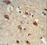 ACP1 / Acid Phosphatase Antibody (aa33-61)