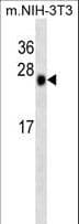 CSNK2B / Phosvitin Antibody