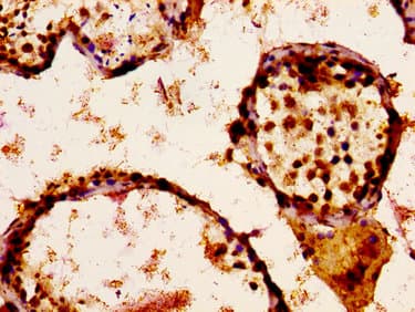 SCN9A / Nav1.7 Antibody