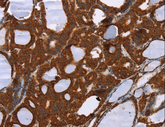 Polyclonal Rabbit anti-Human PPP2R3C Antibody (IHC)
