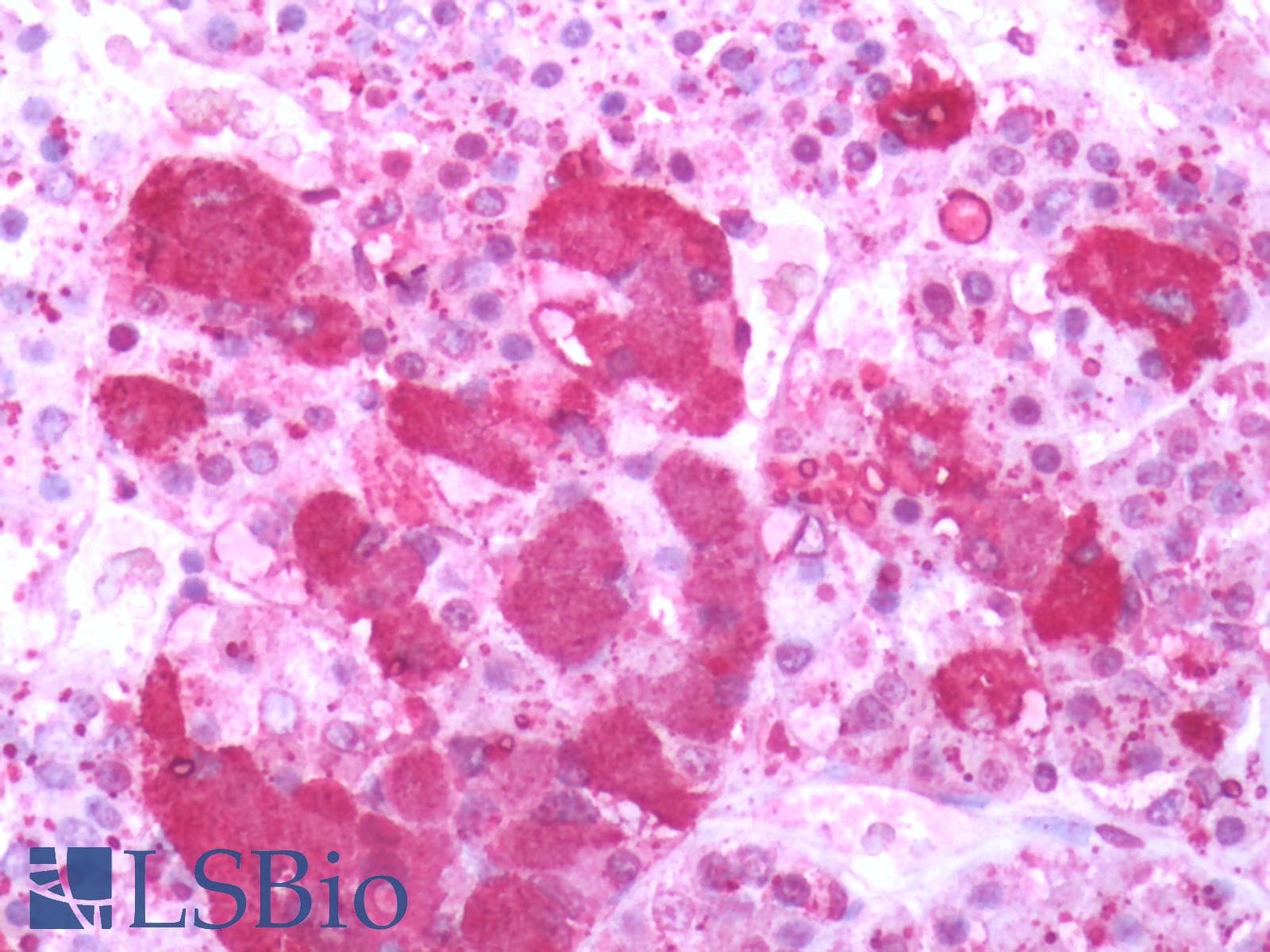 IHC-plus™ Beta Endorphin Antibody
