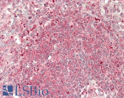 FGF17 Antibody (aa85-134)
