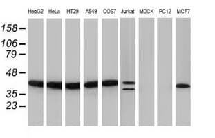 PIH1D2 Antibody (clone OTI5G9)