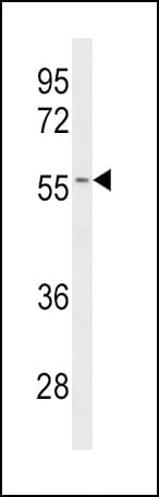 CYP2C19 Antibody (aa257-285)