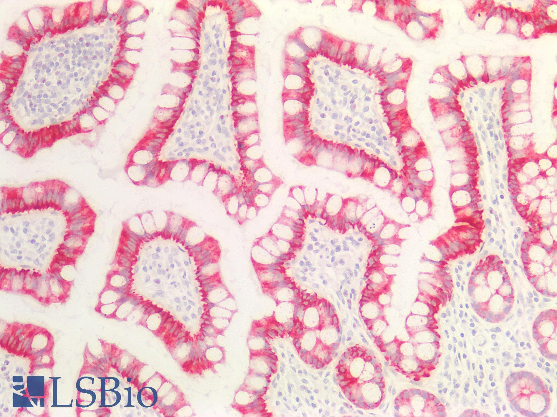 PathPlus™ Acidic Cytokeratin AE1 Antibody (clone AE-1, Concentrated)
