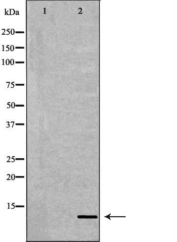 S100A8 / MRP8 Antibody