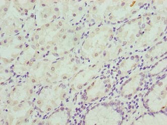 CIPC / KIAA1737 Antibody