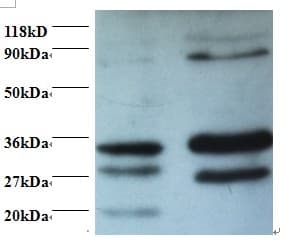 RAD23A / HHR23A Antibody (HRP)