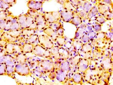 Polyclonal Rabbit anti-Human URI1 / NNX3 Antibody (IHC, WB)