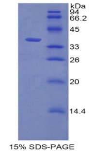 Human CDK2 Protein (Recombinant His, N-Terminal)